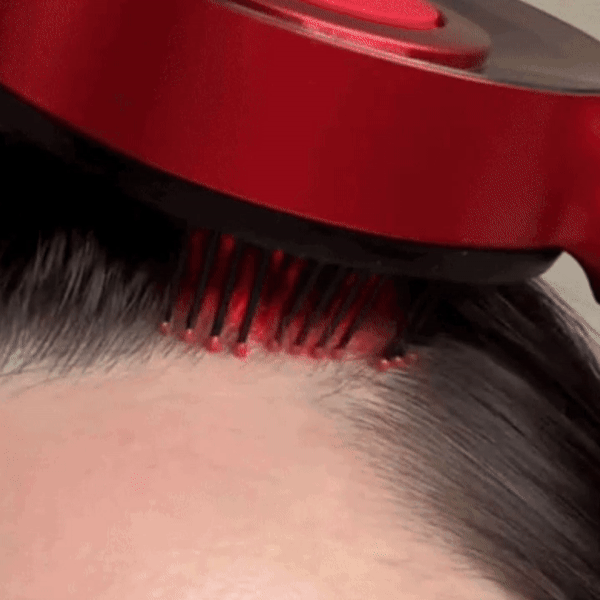 Innovative Hair Therapy at Your Fingertips